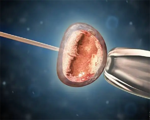 金贝供卵电话(紫多多供卵费用),试管婴儿一代、二代、三代是迭代升级还是互不