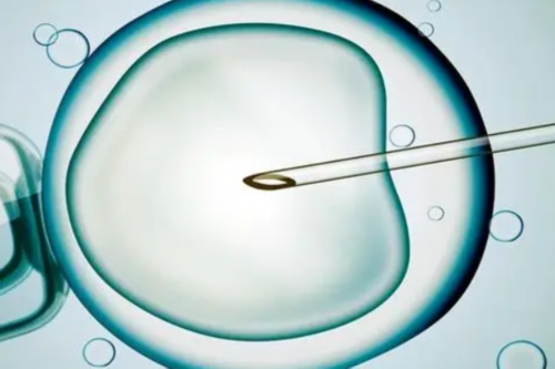 专业海外合法代孕,试管移植为什么要憋尿?试管移植憋尿喝多少水?