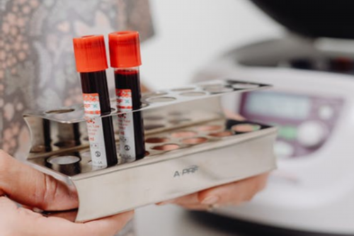 供卵代生公司，扒一扒胚胎停育,初步在家即可判断,B超可直接确诊