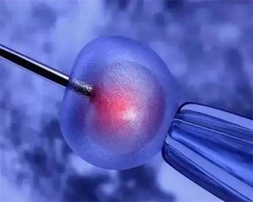 缓解子宫内膜异位症疼痛:饮食的秘诀