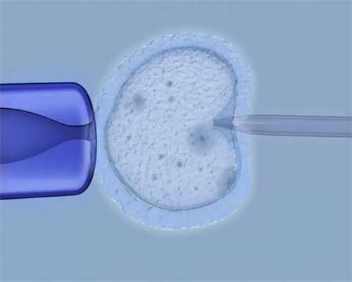 揭示子宫肌瘤的神秘面纱:常见症状及防治指南