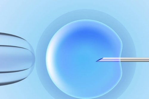 代孕还需要做无创吗(代孕怀孕要做很多检查吗)