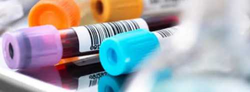 高鹰助孕好贵(南方代孕一键咨询),促排卵后盆腔积液吃肉可不可以？